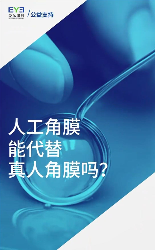 Blog Single