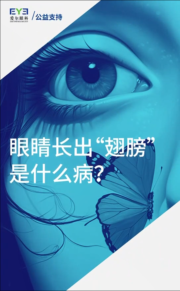 Blog Single